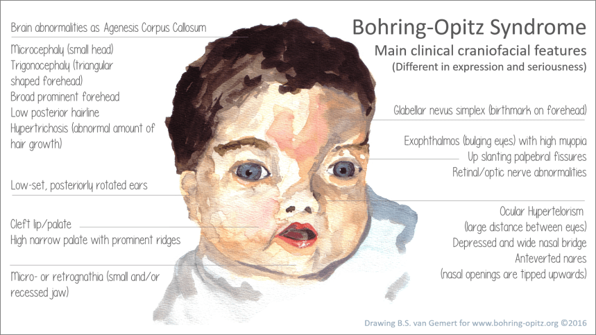 clinical craniofacial features